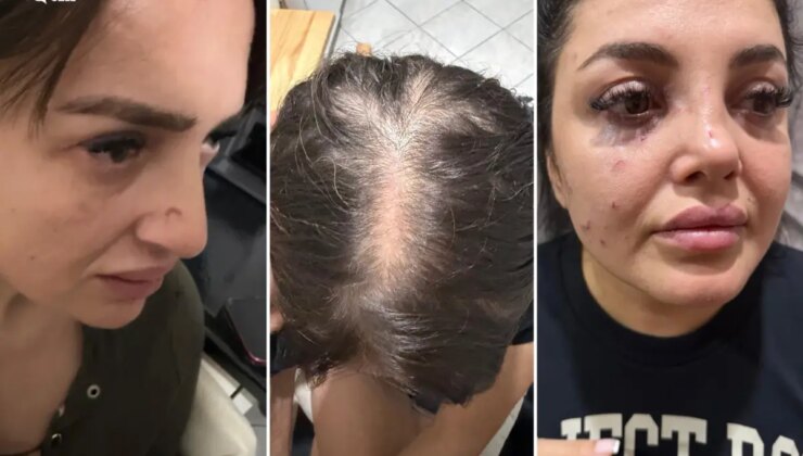 Beykoz’da dehşet anları! Ofisi basan grup eski patronlarını sokak ortasında darp etti