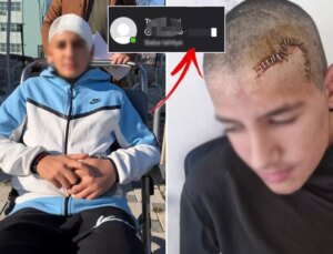 Okul arkadaşı taşla kafasını parçaladı! Tahliye edilen çocuğun paylaşımı çıldırttı